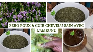 Gardez Votre Cuir Chevelu Sain Avec Cette Plante🌱 [upl. by Notanhoj]