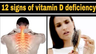 12 Warning signs that body need more vitamin Dsigns and symptoms of vitamin D deficiency [upl. by Heidie617]