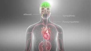 Barostim™ Baroreflex Activation Therapy Animation [upl. by Eanaj]