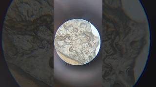 Human Skin Cells Under Microscope magnification microscope science shorts sciencelab [upl. by Virgy]