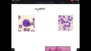 Myeloblast vs lymphoblast [upl. by Akiv]