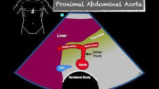 Bedside Ultrasound Abdominal Aorta [upl. by Eema494]