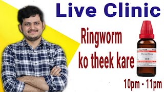 Chrysarobinum for ringworm DrKirti Vikram LIVE CLINIC1306 1732021 [upl. by Anele]