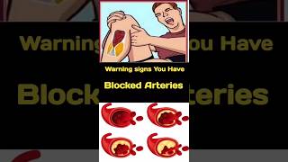 Signs You Have Clogged Arteries amp Heart Problems  cloggedarteries healthylifestyle heartattack [upl. by Tamberg]