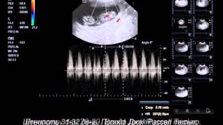 Ultrasonography Pregnant dogs 2132 days [upl. by Ardnuahs]