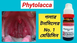 Phytolacca 200 Homeopathic Medicine Uses । Best Homeopathy Medicine for Tonsilitis । [upl. by Midas]