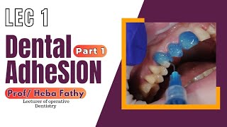 Operative 4  Lec 1  Dental Adhesion Part 1 [upl. by Rocco642]