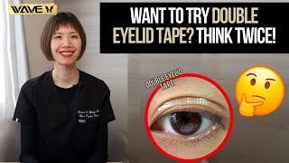 Transform Your Eyes Double Eyelid Tape vs Upper Blepharoplasty [upl. by Trimmer395]