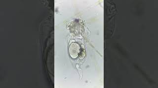 This rotifer has an egg inside it [upl. by Tzong622]