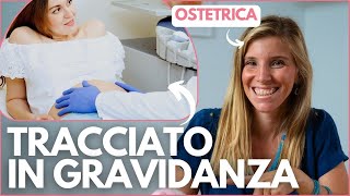 TRACCIATO IN GRAVIDANZA Cosè come funziona a cosa serve e quando si esegue la cardiotocografia [upl. by Akissej]