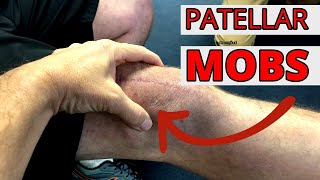 Patellar Mobility After Knee Replacement ClinicCAM [upl. by Nohtanhoj765]