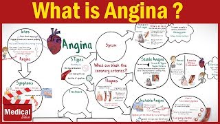 Pharmacology  What is Angina Pectoris  Types of Angina Symptoms Causes ampTreatment FROM A TO Z [upl. by Thurlow]