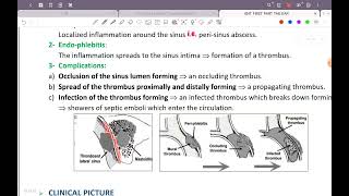 Rev  Chapter 7  Complications of otitis media  ENT 42 [upl. by Lihas]