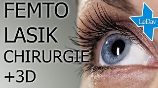 FEMTO LASIK  Chirurgie  3D avec commentaires [upl. by Uba]