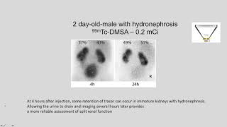 Renal functional imaging [upl. by Atalya]