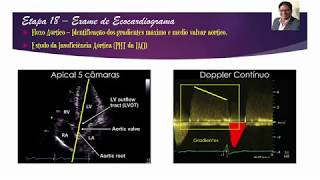 EPISÓDIO 18 Fluxo Contínuo Aórtico [upl. by Naoh]