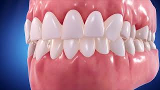 Straighter Teeth and Whole Body Health [upl. by Arhna242]