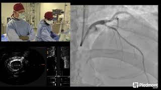 Coronary Live Case for SCAI Scientific Sessions [upl. by Caryn467]