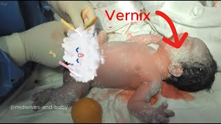 Do you know anything about the vernix layer of newborns [upl. by Gnel]