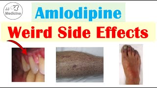 Amlodipine Weird Side Effects Skin Gastrointestinal Psychological [upl. by Aehsal]