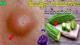 Lipoma Ayurvedic Treatment  lipoma mane maddu  lipoma ayurvedic treatment kannada  kobbina gantu [upl. by Swanhildas]