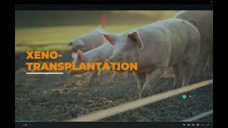 Xenotransplantation Using Porcine Kidneys to Solve the Organ Shortage [upl. by Etnahs]