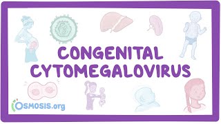 Congenital CMV  causes symptoms diagnosis treatment pathology [upl. by Casabonne]