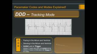 Pacemaker Codes and Modes  Explained [upl. by Salim]