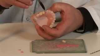 Deflex flexible dentures Video 7 Addition through reinjection [upl. by Brocklin]