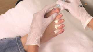 Tuto nail art pour ongles de pied  technique du millefeuille  ndedfr [upl. by Kleiman]