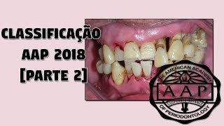 Parte 2 Classificação das Doenças Periodontais 2018  Nova Classificação da AAP 2018 [upl. by Salkcin651]