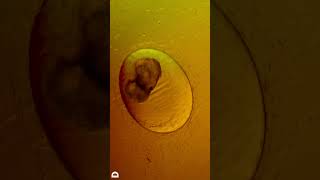 Embryo inside a snail egg [upl. by Innek587]