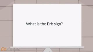 What is the Erb sign [upl. by Anaib822]