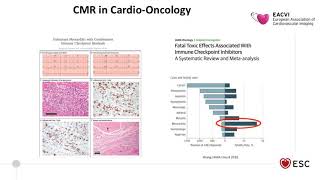 EACVI free webinar Highlights of EuroCMR 2019 [upl. by Carmella]