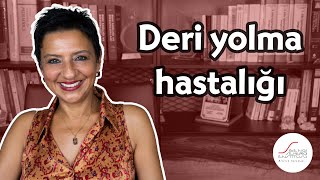 Deri yolma hastalığı [upl. by Anastasius256]