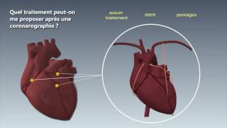 INFOCORONAROGRAPHIE [upl. by Nedyarb]