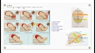 모성간호 간호사 국가고시 기출문제 유형 두정위 분만기전 앙와위성 저혈압 호흡성 알칼리증 [upl. by Raveaux937]