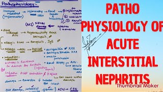 Pathophysiology of acute interstitial nephritis  MEDICINE with DR SHAMAMA [upl. by Dihaz]