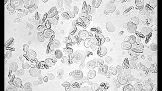 Heat Gelatinization of Wheat Starch low iodine [upl. by Ennaylime824]