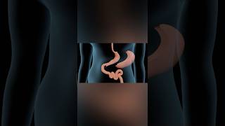 Sleeve Gastrectomy medicalanimation health shorts [upl. by Adleremse]