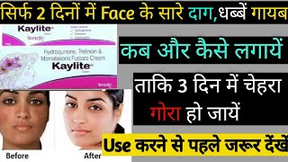 kaylite cream ke fayde nukshanuses price  gora hone ka cream  fairness cream  kaylite [upl. by Sweatt833]