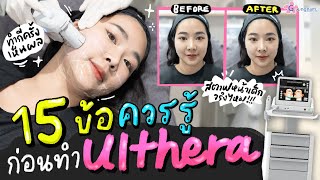 คลิปเดียวจบ สรุปทุกเรื่องที่ต้องรู้เกี่ยวกับ Ulthera [upl. by Nakada]