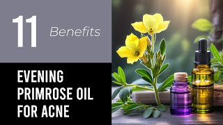 11 Wonders of Evening Primrose Oil For Acne [upl. by Gypsie]