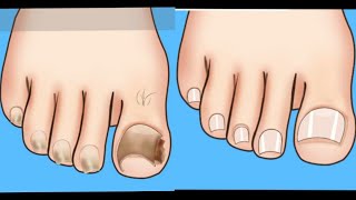 Feet and Toenails Pedicare Satisfying  ASMR [upl. by Ennail]