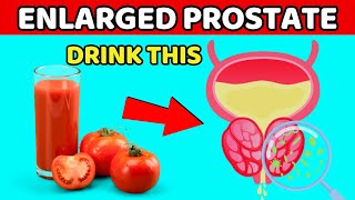 TOP 10 BEST FOODS FOR PROSTATE HEALTH [upl. by Boggs353]