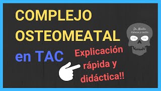 COMPLEJO OSTEOMEATAL ➡️ TAC [upl. by Onida]