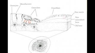 Understanding the Natural Approach to Osteoporosis  Part 1 [upl. by Lamprey]