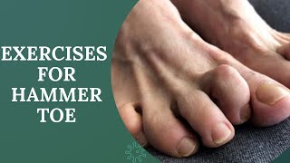 hammer toes correctionexercise for hammer toemallet toe exercisesPhysiotherapyTreatments [upl. by Crescint]