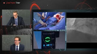 Shockwave IVL Coronary RealWorld Cases Outcomes amp Algorithms An InCathLab Webinar [upl. by Aratal]