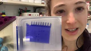 Coomassie Brilliant Blue Dye  the science of SDSPAGE staining [upl. by Worrell]